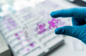 Histology slide being held by a gloved researcher in a laboratory